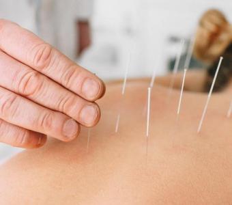 Discover the Effective Acupuncture Services in Denver to Heal Yourself