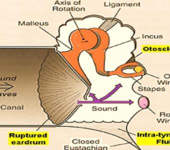 A Top Choice for Ear-Related Care in Mumbai