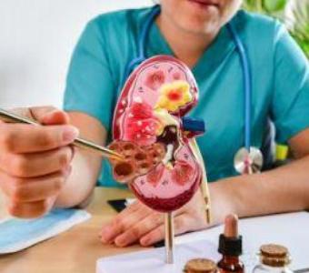 Ayurvedic treatment for Kidney in Ahmedabad