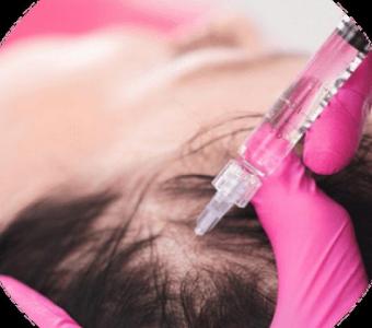 Restore Your Hair Naturally with PRF Injections