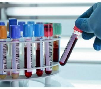 Top Biobanking  Services In Hyderabad