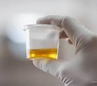 Leading Urine Sample Collection Service in Hyderabad