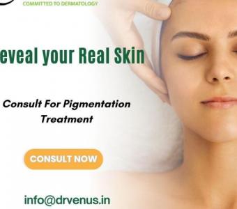 Best Pigmentation Treatment Hyderabad