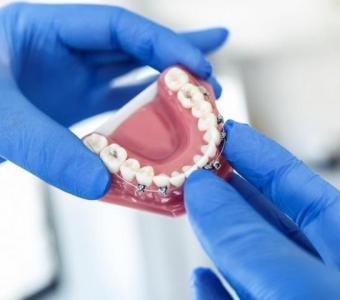 Why Do Teeth Need Root Canals in Preston?