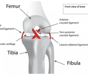 Ligament Injuries London