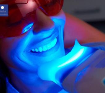 Achieve a Brighter Smile with the Best Professional Teeth Whitening