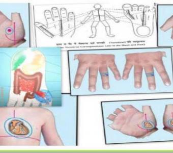 neurology acupressure doctor in ahmedabad