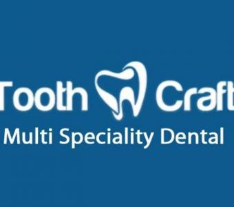 Affordable Root Canal Treatment Cost in Chennai