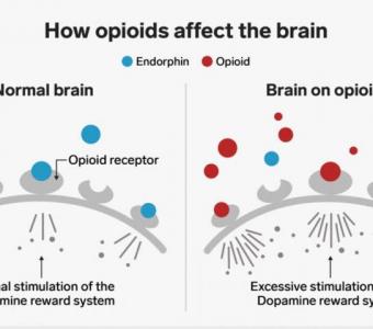 Opioid Abuse Treatment & Rehab Centers in India | FindRehabCentres