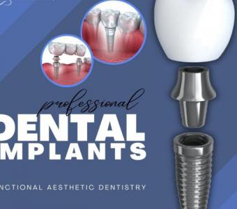 Experience Superior Dental Implant Solutions in Summerlin at Functional Aesthetic Dentistry