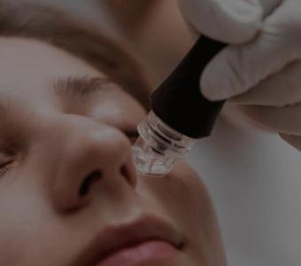 Radio Frequency Skin Treatment in London, ON | Care Plus Medical Aesthetics