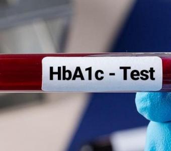 HbA1c Test: Monitor Your Blood Sugar Levels for Diabetes Management