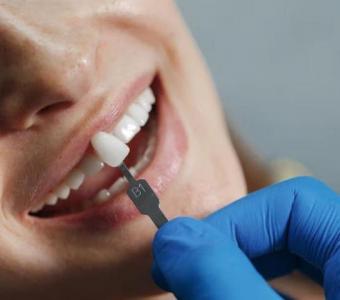 dental implant treatment in nehrunagar ahmedabad